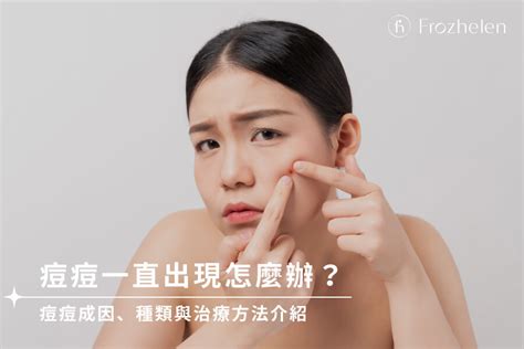 眉毛尾端長痘痘|眉尾長痘痘怎麼辦？專家教你有效緩解方法